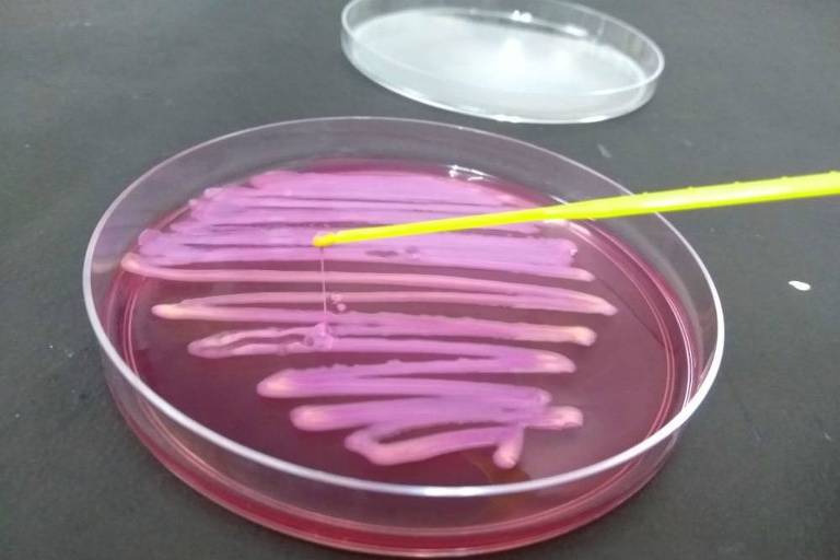 Estudo revela que bactérias do próprio corpo podem causar infecções graves
