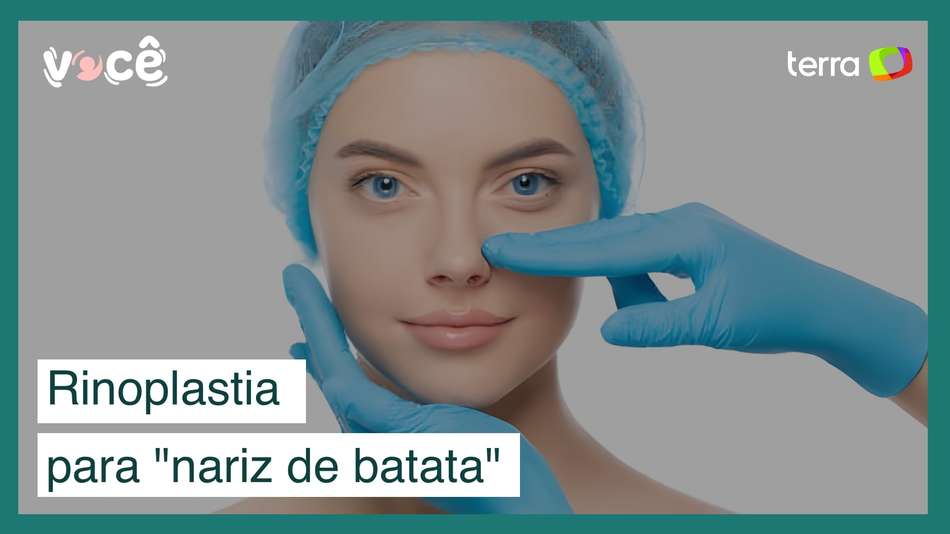 Rinoplastia: a cirurgia plástica mais procurada no Brasil