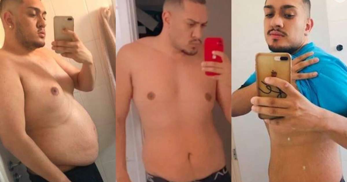 Jojo Todynho faz antes e depois com menos 30 Kg após cirurgia bariátrica.  Confira!