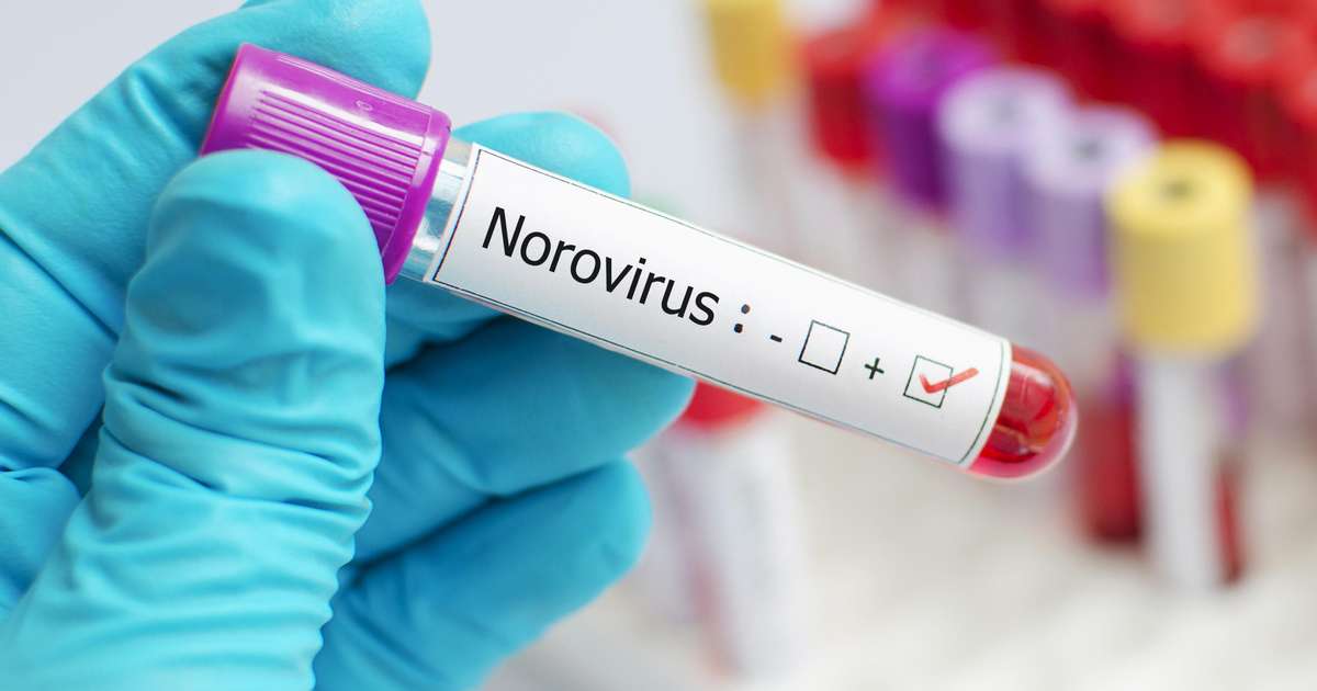 Aumento de casos de norovírus preocupa autoridades de saúde nos EUA e Brasil